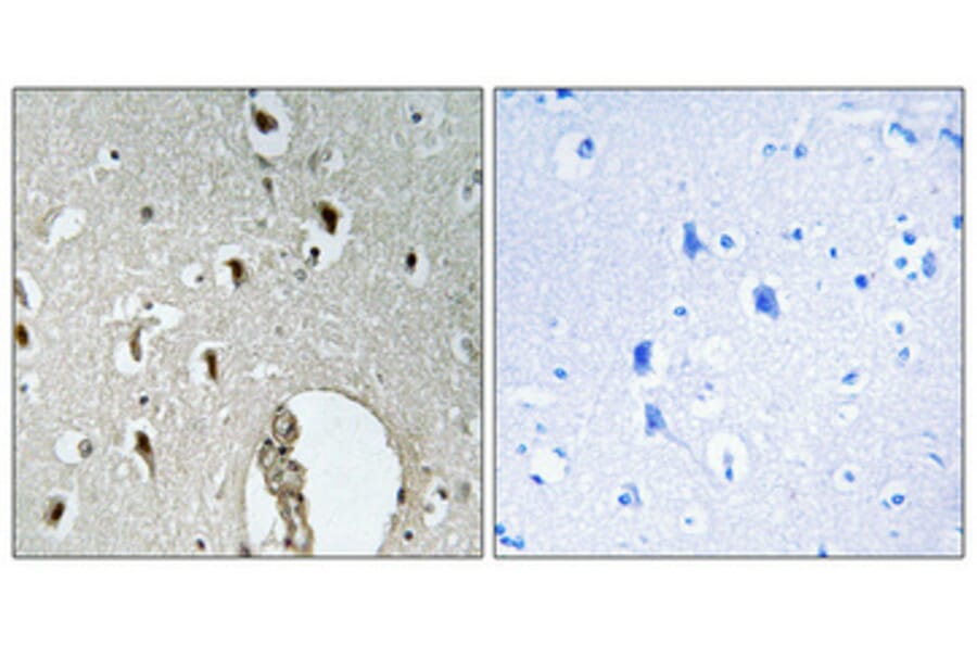 Immunohistochemistry - Anti-HLX1 Antibody (C11046) - Antibodies.com
