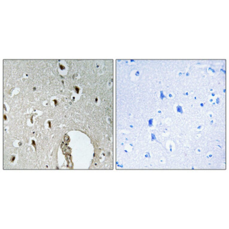 Immunohistochemistry - Anti-HLX1 Antibody (C11046) - Antibodies.com
