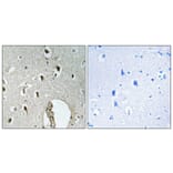Immunohistochemistry - Anti-HLX1 Antibody (C11046) - Antibodies.com
