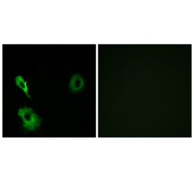 Immunofluorescence - Anti-GRM7 Antibody (G367) - Antibodies.com