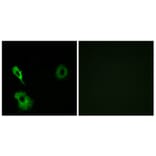 Immunofluorescence - Anti-GRM7 Antibody (G367) - Antibodies.com