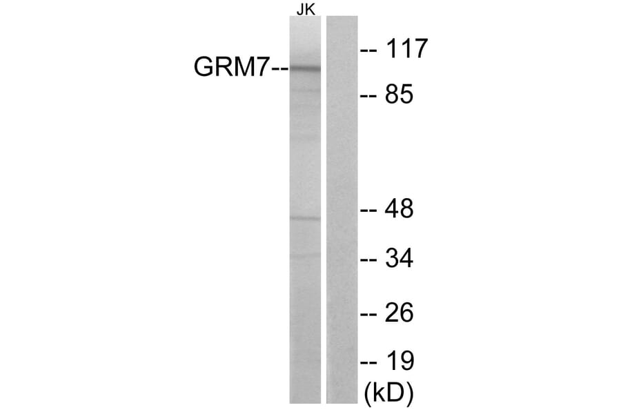 Western Blot - Anti-GRM7 Antibody (G367) - Antibodies.com