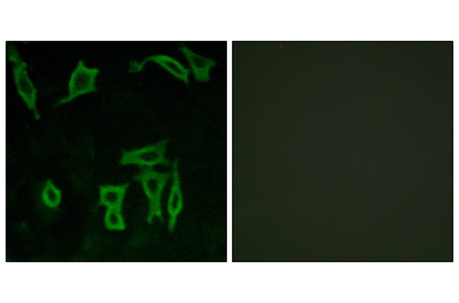 Immunofluorescence - Anti-GRM5 Antibody (G365) - Antibodies.com