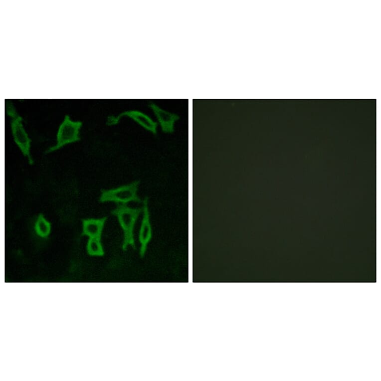 Immunofluorescence - Anti-GRM5 Antibody (G365) - Antibodies.com