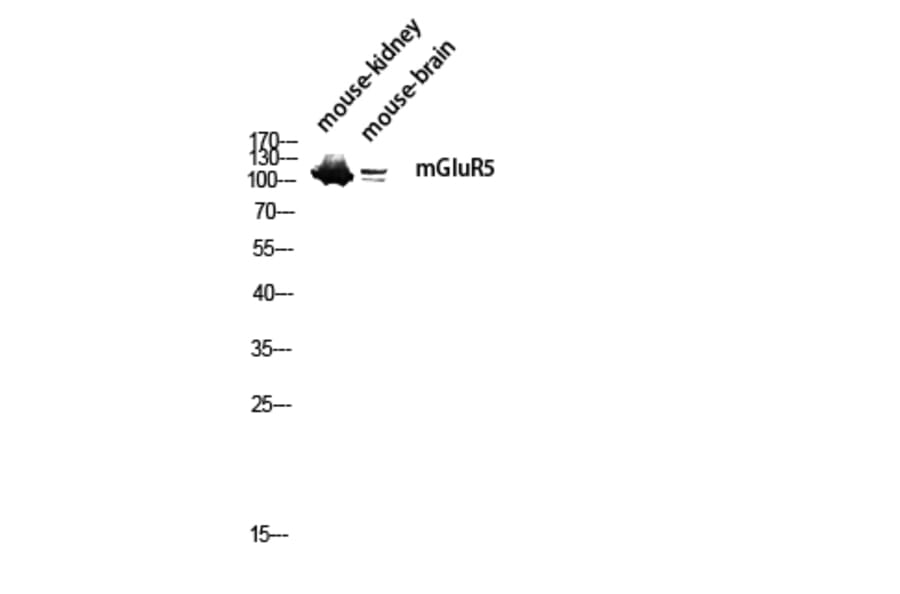 Western Blot - Anti-GRM5 Antibody (G365) - Antibodies.com