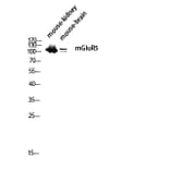 Western Blot - Anti-GRM5 Antibody (G365) - Antibodies.com