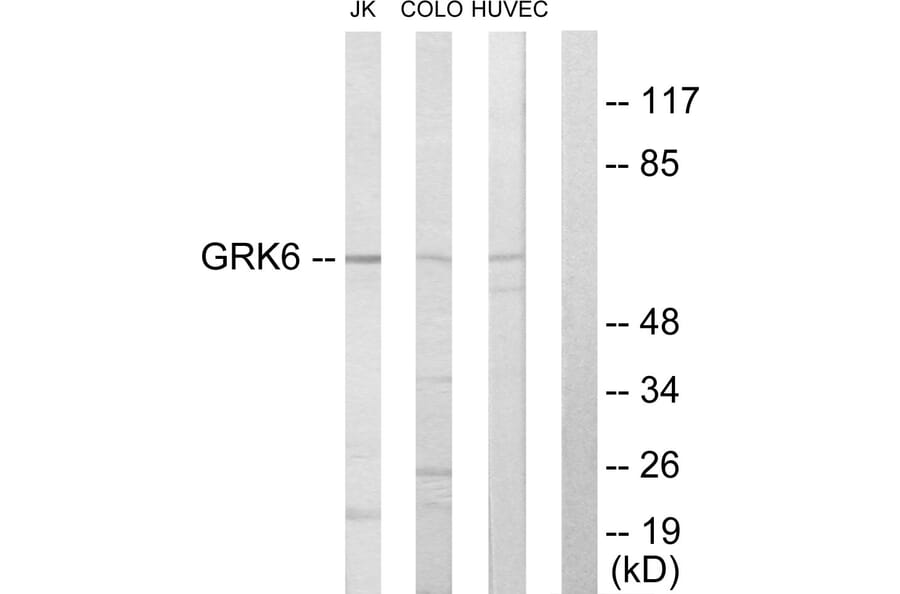 Western Blot - Anti-GRK6 Antibody (C10613) - Antibodies.com