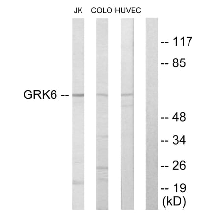 Western Blot - Anti-GRK6 Antibody (C10613) - Antibodies.com
