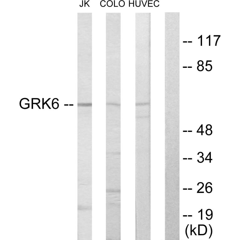 Western Blot - Anti-GRK6 Antibody (C10613) - Antibodies.com