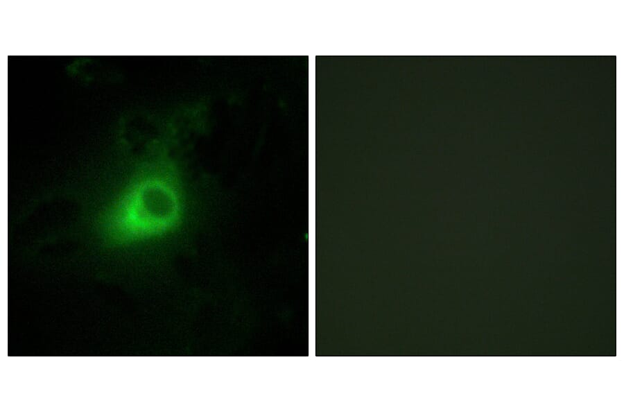 Immunofluorescence - Anti-GRK6 Antibody (C10613) - Antibodies.com