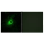 Immunofluorescence - Anti-GRK6 Antibody (C10613) - Antibodies.com