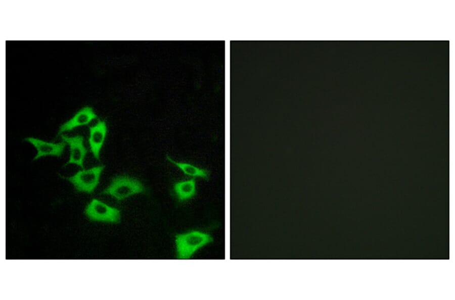 Immunofluorescence - Anti-FZD8 Antibody (G113) - Antibodies.com