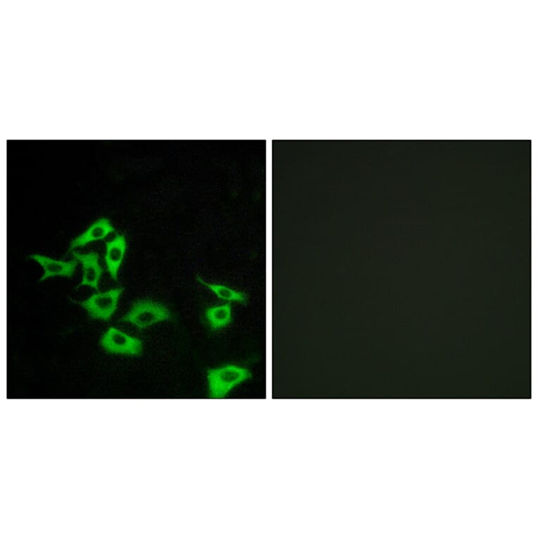 Immunofluorescence - Anti-FZD8 Antibody (G113) - Antibodies.com