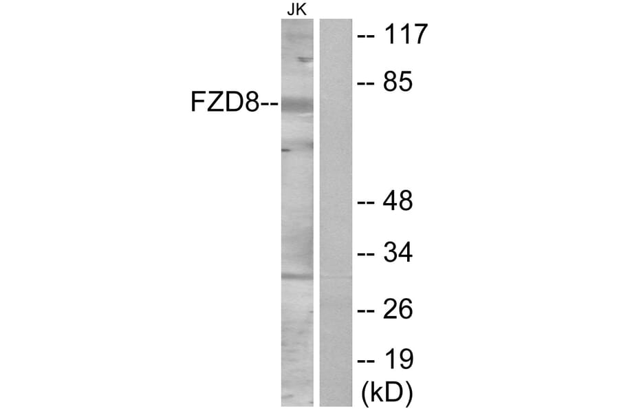 Western Blot - Anti-FZD8 Antibody (G113) - Antibodies.com