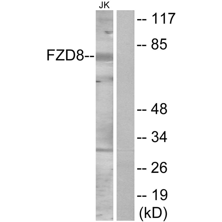 Western Blot - Anti-FZD8 Antibody (G113) - Antibodies.com