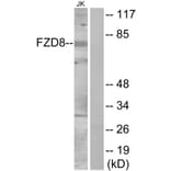 Western Blot - Anti-FZD8 Antibody (G113) - Antibodies.com