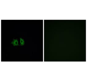 Immunofluorescence - Anti-FZD5 Antibody (G259) - Antibodies.com