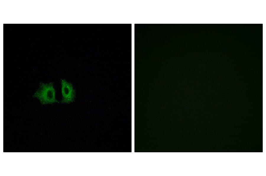 Immunofluorescence - Anti-FZD5 Antibody (G259) - Antibodies.com