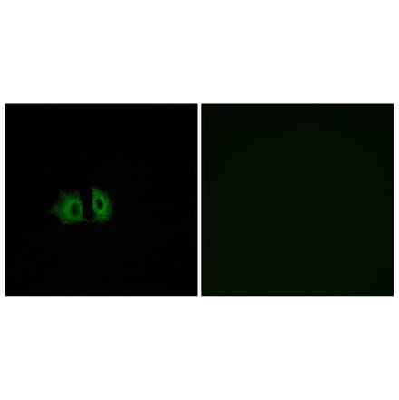 Immunofluorescence - Anti-FZD5 Antibody (G259) - Antibodies.com