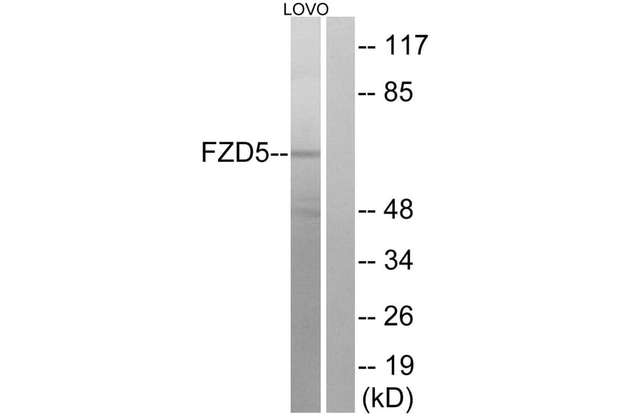 Western Blot - Anti-FZD5 Antibody (G259) - Antibodies.com