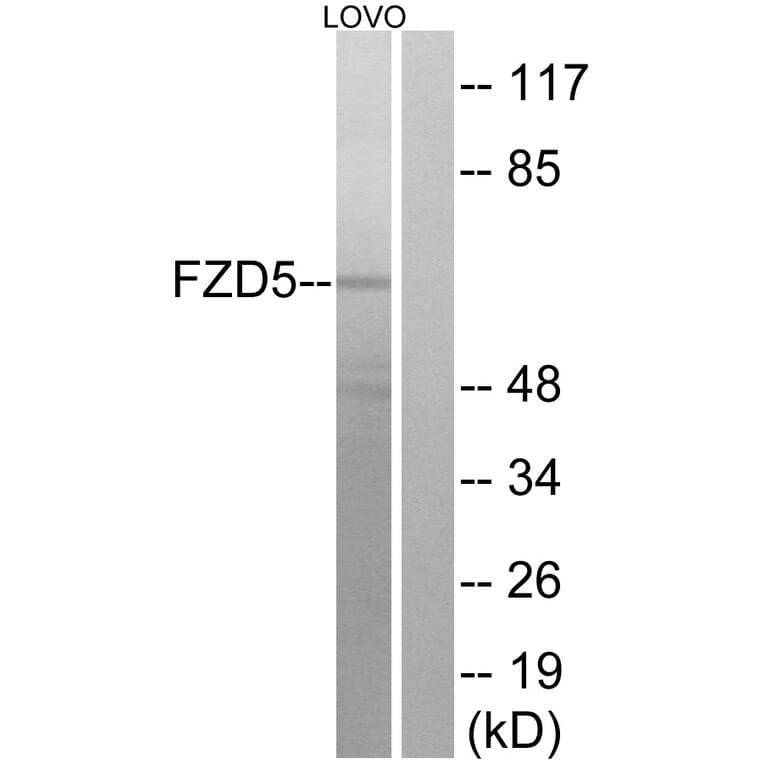 Western Blot - Anti-FZD5 Antibody (G259) - Antibodies.com