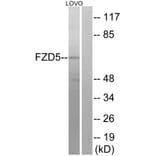 Western Blot - Anti-FZD5 Antibody (G259) - Antibodies.com
