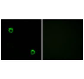 Immunofluorescence - Anti-FZD2 Antibody (G107) - Antibodies.com