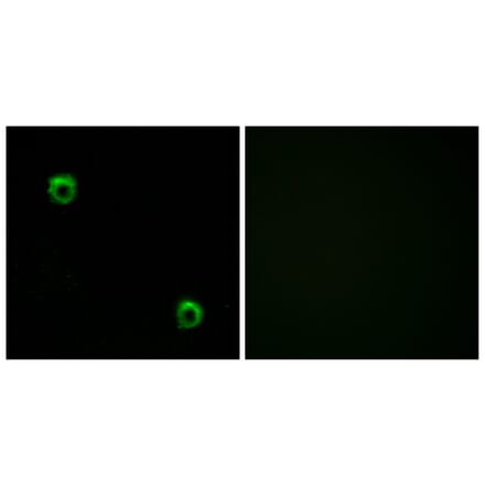 Immunofluorescence - Anti-FZD2 Antibody (G107) - Antibodies.com