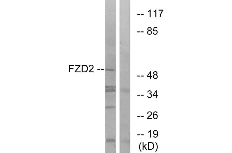 Western Blot - Anti-FZD2 Antibody (G107) - Antibodies.com