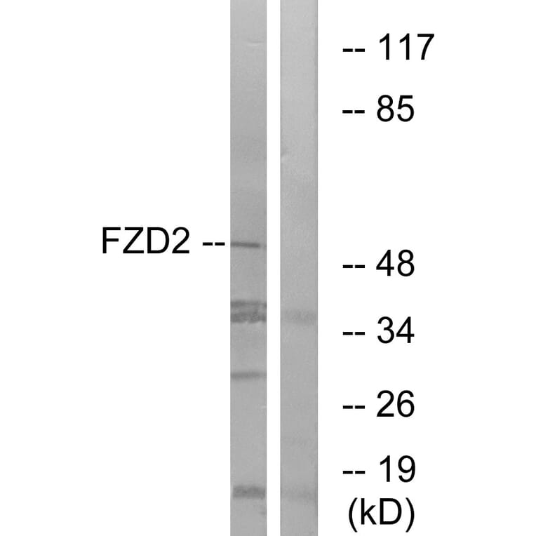Western Blot - Anti-FZD2 Antibody (G107) - Antibodies.com