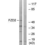 Western Blot - Anti-FZD2 Antibody (G107) - Antibodies.com
