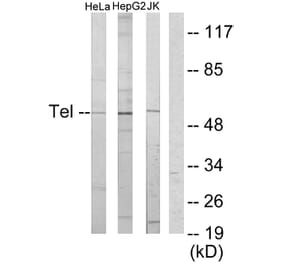 Western Blot - Anti-ETV6 Antibody (C10593) - Antibodies.com