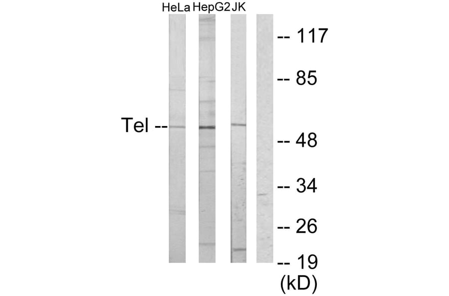 Western Blot - Anti-ETV6 Antibody (C10593) - Antibodies.com