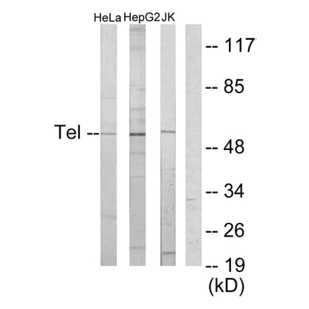 Western Blot - Anti-ETV6 Antibody (C10593) - Antibodies.com