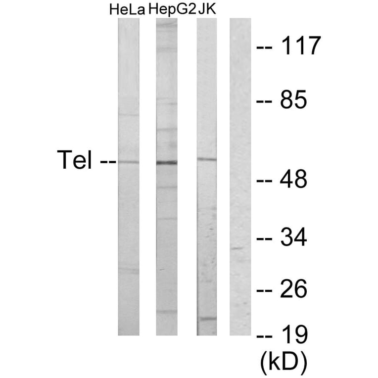 Western Blot - Anti-ETV6 Antibody (C10593) - Antibodies.com