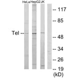 Western Blot - Anti-ETV6 Antibody (C10593) - Antibodies.com