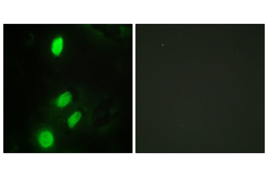 Immunofluorescence - Anti-ETV6 Antibody (C10593) - Antibodies.com