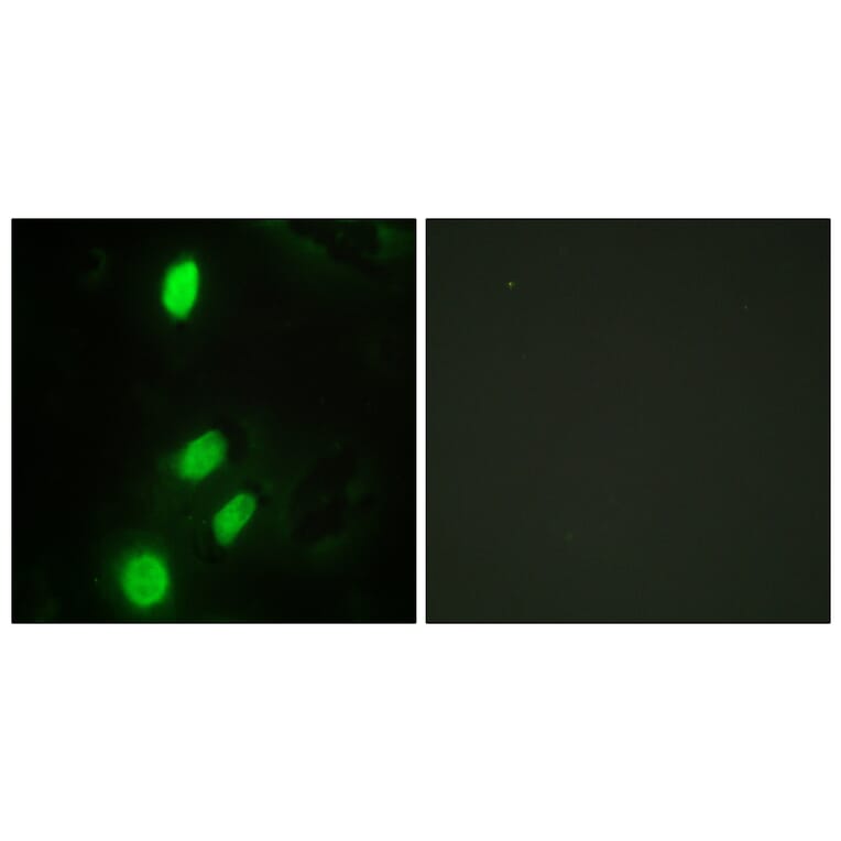 Immunofluorescence - Anti-ETV6 Antibody (C10593) - Antibodies.com