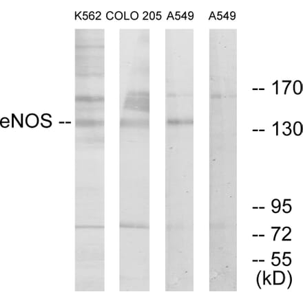 Western Blot - Anti-eNOS Antibody (B1146) - Antibodies.com