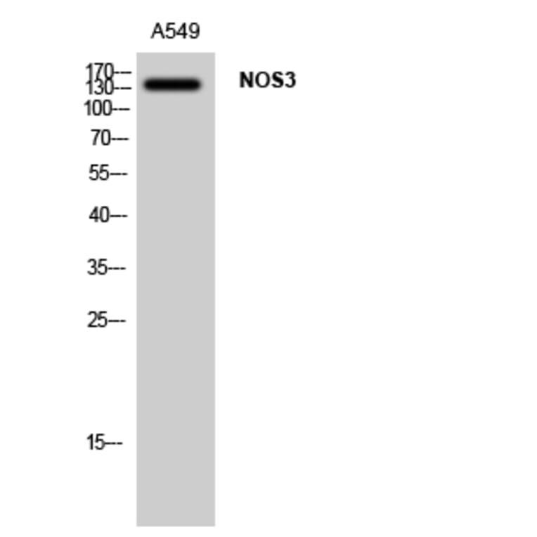 Western Blot - Anti-eNOS Antibody (B1146) - Antibodies.com