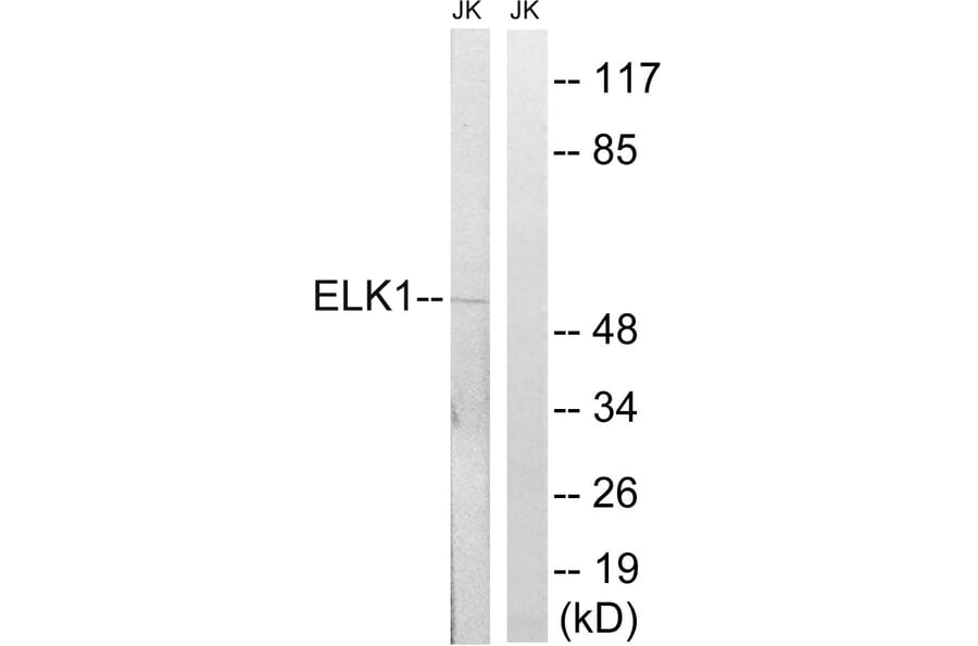 Western Blot - Anti-Elk1 Antibody (B7068) - Antibodies.com