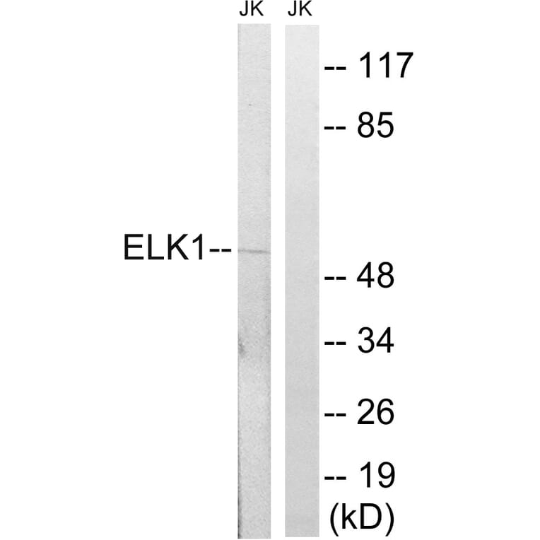Western Blot - Anti-Elk1 Antibody (B7068) - Antibodies.com