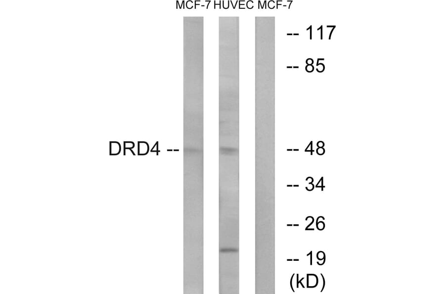 Western Blot - Anti-DRD4 Antibody (G079) - Antibodies.com