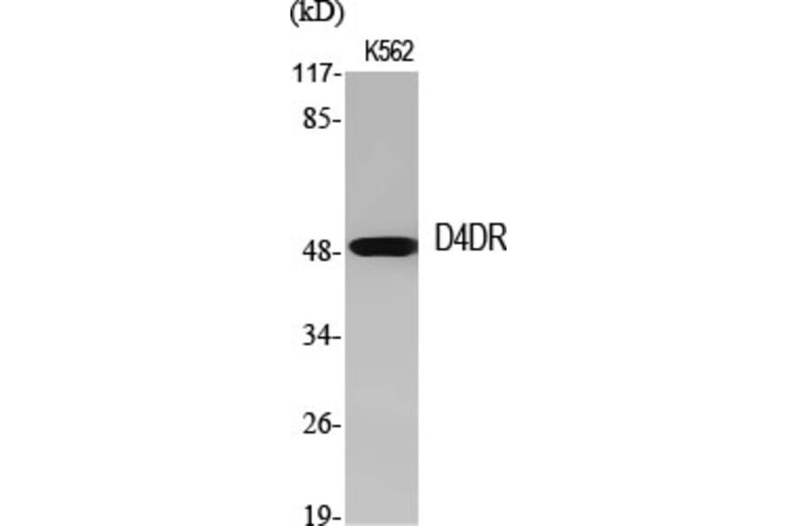 Western Blot - Anti-DRD4 Antibody (G079) - Antibodies.com