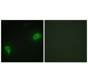 Immunofluorescence - Anti-DOK7 Antibody (C11148) - Antibodies.com