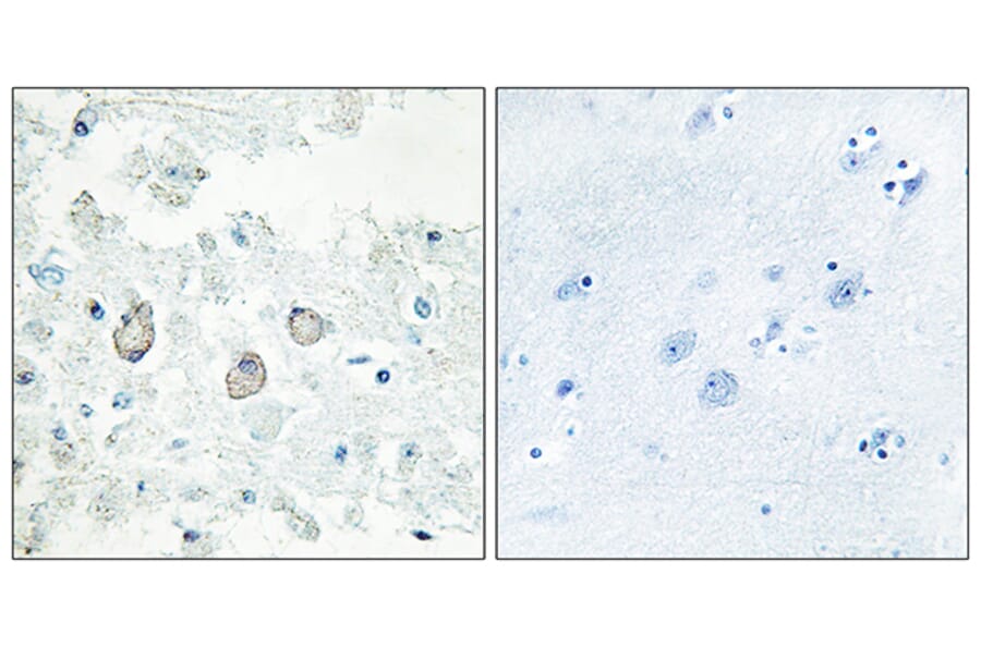 Immunohistochemistry - Anti-DOK7 Antibody (C11148) - Antibodies.com