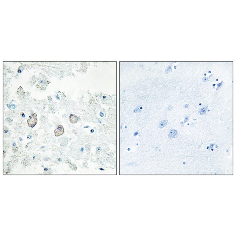 Immunohistochemistry - Anti-DOK7 Antibody (C11148) - Antibodies.com