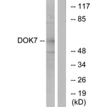 Western Blot - Anti-DOK7 Antibody (C11148) - Antibodies.com