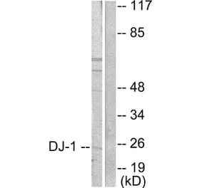 Western Blot - Anti-DJ-1 Antibody (C0172) - Antibodies.com