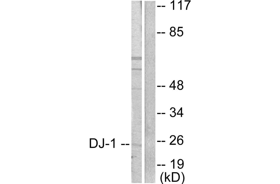 Western Blot - Anti-DJ-1 Antibody (C0172) - Antibodies.com